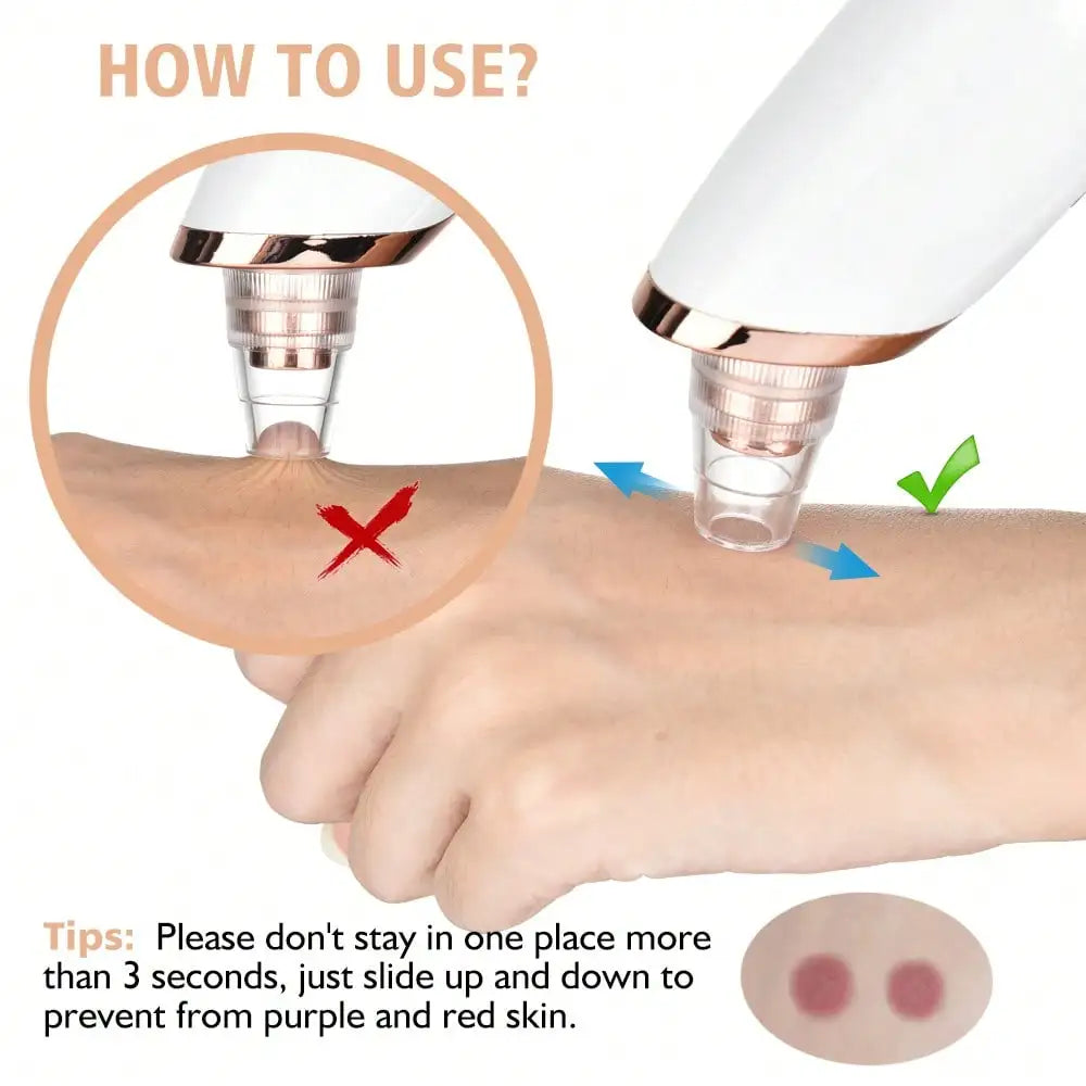 Electric Vacuum Suction Blackhead Remover For Facial Pore Cleaning