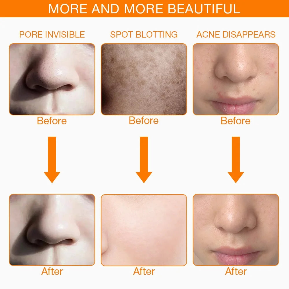Iebelif LED Light Therapy Face Mask For Skin Rejuvenation