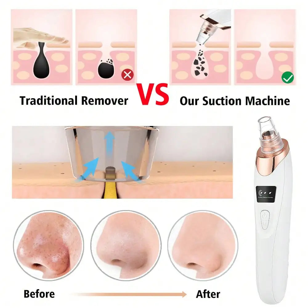 Electric Vacuum Suction Blackhead Remover For Facial Pore Cleaning