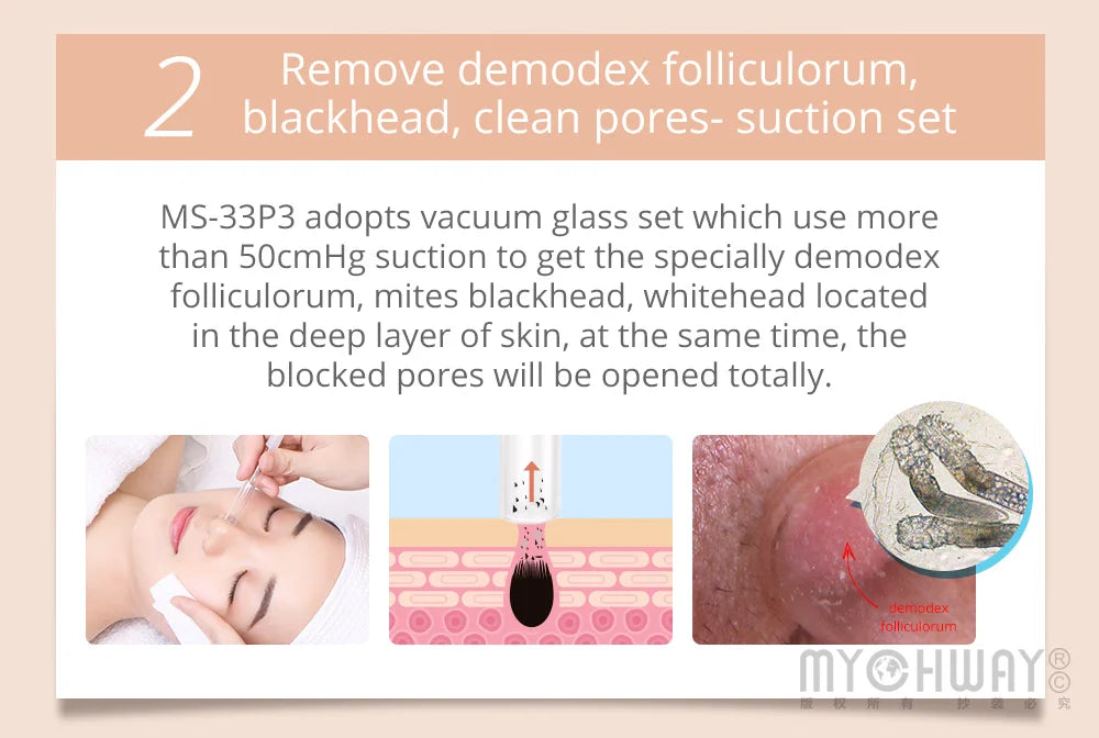 Mychway 3 In 1 Ultrasound Dermabrasion Facial Beauty Device